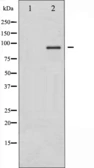 Anti-IKK alpha + IKK beta antibody used in Western Blot (WB). GTX52347