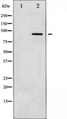 Anti-PKC-pan antibody used in Western Blot (WB). GTX52352