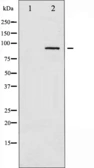 Anti-alpha Adducin antibody used in Western Blot (WB). GTX52357