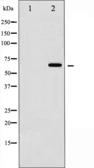 Anti-SMAD2 / SMAD3 antibody used in Western Blot (WB). GTX52368