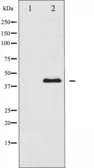 Anti-MEK1 + MEK2 antibody used in Western Blot (WB). GTX52369