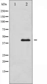 Anti-MEK1 + MEK2 antibody used in Western Blot (WB). GTX52370