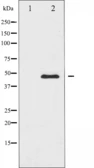 Anti-CaMK2 alpha/delta antibody used in Western Blot (WB). GTX52377