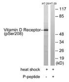 Anti-Vitamin D Receptor (phospho Ser208) antibody used in Western Blot (WB). GTX52380