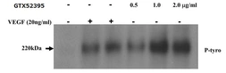 Anti-VEGF Receptor 2 antibody used in Activation/Stimulation/Induction (Activation). GTX52395