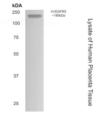 Anti-VEGF Receptor 3 antibody [7G63] used in Western Blot (WB). GTX52456