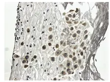Anti-PDGF Receptor alpha antibody [8A89] used in IHC (Paraffin sections) (IHC-P). GTX52457