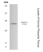 Anti-PDGF beta antibody [5F66] used in Western Blot (WB). GTX52467
