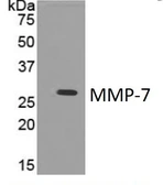 Anti-MMP7 antibody [4C21] used in Western Blot (WB). GTX52475