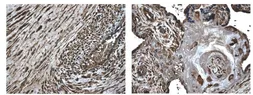 Anti-MMP8 antibody [7A11] used in IHC (Paraffin sections) (IHC-P). GTX52476
