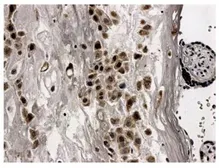 Anti-CD62E antibody [9E7] used in IHC (Paraffin sections) (IHC-P). GTX52484