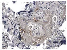 Anti-Angiogenin antibody [7M15] used in IHC (Paraffin sections) (IHC-P). GTX52495