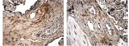 Anti-BMPR1A antibody [8L7] used in IHC (Paraffin sections) (IHC-P). GTX52504