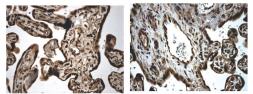Anti-TGF beta Receptor III antibody [5G9] used in IHC (Paraffin sections) (IHC-P). GTX52508