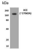 Anti-ACE antibody [12J16] used in Western Blot (WB). GTX52523