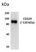 Anti-CD229 antibody [3L25] used in Western Blot (WB). GTX52616