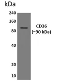 Anti-CD36 antibody [7K35] used in Western Blot (WB). GTX52623