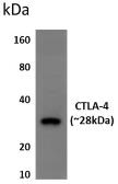 Anti-CTLA4 antibody [8F16] used in Western Blot (WB). GTX52659