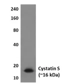 Anti-Cystatin S antibody [4L25] used in Western Blot (WB). GTX52685