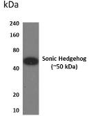 Anti-Shh antibody [2G19] used in Western Blot (WB). GTX52693