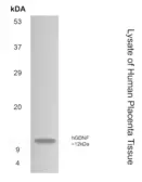 Anti-GDNF antibody [12F9] used in Western Blot (WB). GTX52761