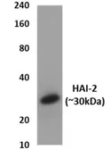 Anti-HAI-2 antibody [3S24] used in Western Blot (WB). GTX52776