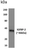 Anti-IGFBP2 antibody [6T32] used in Western Blot (WB). GTX52794