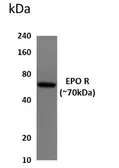 Anti-EPO receptor antibody [6A33] used in Western Blot (WB). GTX52803