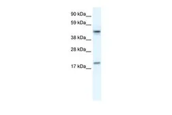 Anti-PDCD4 antibody, N-term used in Western Blot (WB). GTX52831