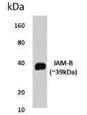 Anti-JAM-B antibody [4L28] used in Western Blot (WB). GTX52880