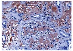 Anti-LECT2 antibody [4B24] used in Immunohistochemistry (IHC). GTX52904