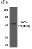 Anti-CCN3 antibody [7H11] used in Western Blot (WB). GTX52948