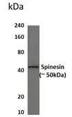 Anti-Spinesin antibody [5B52] used in Western Blot (WB). GTX53013