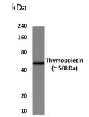 Anti-LAP2 antibody [8S37] used in Western Blot (WB). GTX53024