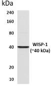 Anti-WISP1 antibody [7H14] used in Western Blot (WB). GTX53058