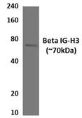 Anti-TGFBI antibody [30G12] used in Western Blot (WB). GTX53070