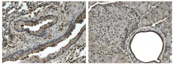 Anti-PDGF Receptor beta antibody [4C54] used in IHC (Paraffin sections) (IHC-P). GTX53097