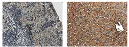 Anti-IL1 Receptor 2 antibody [7D7] used in IHC (Paraffin sections) (IHC-P). GTX53105