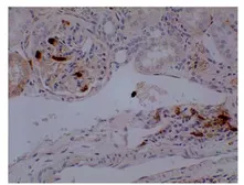 Anti-Neutrophils antibody [3G23] used in IHC (Paraffin sections) (IHC-P). GTX53119