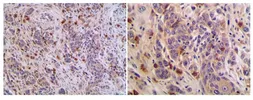 Anti-CD40L / CD154 antibody [MAB0712] used in IHC (Paraffin sections) (IHC-P). GTX53130