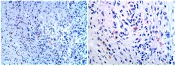Anti-CD80 antibody [MAB0713] used in IHC (Paraffin sections) (IHC-P). GTX53131