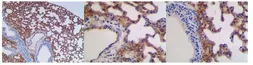 Anti-ICAM1 / CD54 antibody [MAB0802] used in IHC (Paraffin sections) (IHC-P). GTX53133