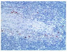 Anti-CD40 antibody [MAB0805] used in IHC (Paraffin sections) (IHC-P). GTX53136