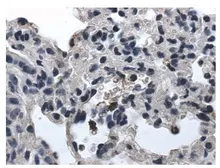 Anti-Integrin alpha E antibody [7A3] used in IHC (Paraffin sections) (IHC-P). GTX53154