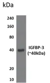Anti-IGFBP3 antibody [11B16] used in Western Blot (WB). GTX53186