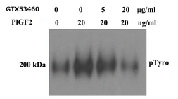 Anti-PLGF antibody [9G33] used in Neutralizing/Blocking/Inhibition (Neutralizing/Inhibition). GTX53460