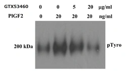 Anti-PLGF antibody [9G33] used in Neutralizing/Blocking/Inhibition (Neutralizing /Inhibition). GTX53460