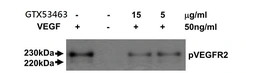 Anti-VEGF Receptor 2 antibody [MAB0701] used in Neutralizing/Blocking/Inhibition (Neutralizing/Inhibition). GTX53463