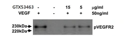 Anti-VEGF Receptor 2 antibody [MAB0701] used in Neutralizing/Blocking/Inhibition (Neutralizing /Inhibition). GTX53463