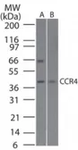Anti-CCR4 antibody used in Western Blot (WB). GTX53474